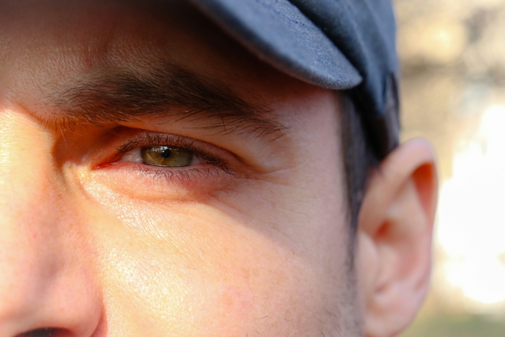 Cataracts and Light Sensitivity: Eye Glare and Discomfort