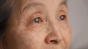 Cataract Surgery Safety: Understanding Risks, Success Rates & Modern Technology