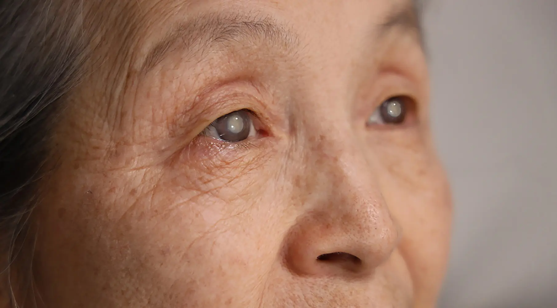 Cataract Surgery Safety: Understanding Risks, Success Rates & Modern Technology