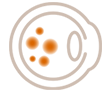 Age-Related Macular Degeneration