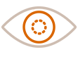 cataracts