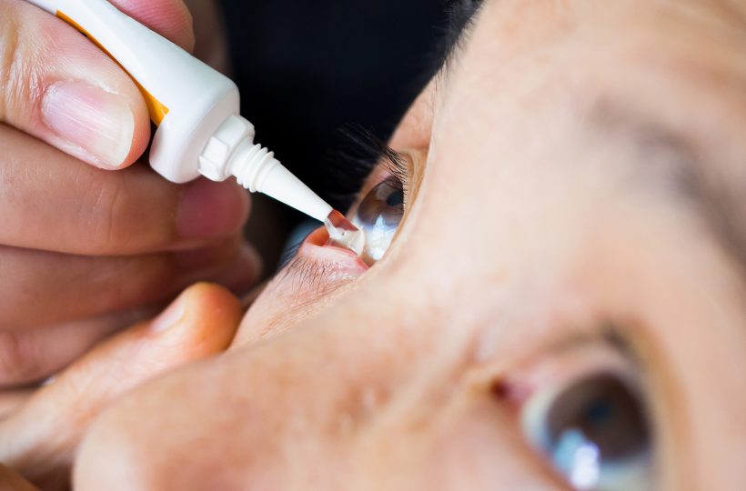 Dry Eyes & Ocular Surface Conditions